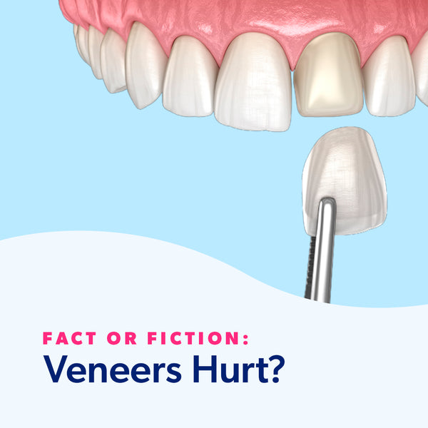 Fact or Fiction: Veneers Hurt?
