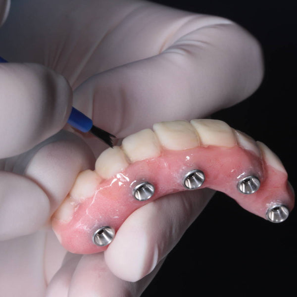Crowns, Bridges, and Implants, Oh My!