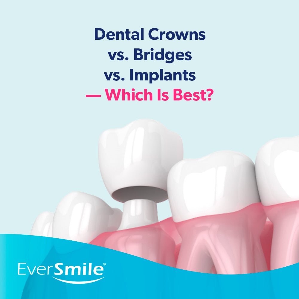 Dental Crowns vs. Bridges vs. Implants — Which Is Best?