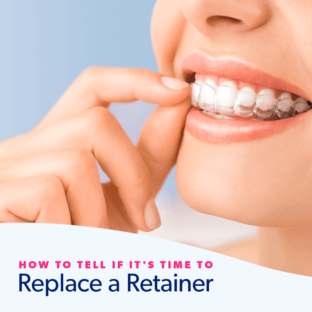 How to Tell if It's Time to Replace a Retainer