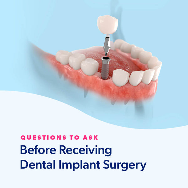 Questions to Ask Before Receiving Dental Implant Surgery