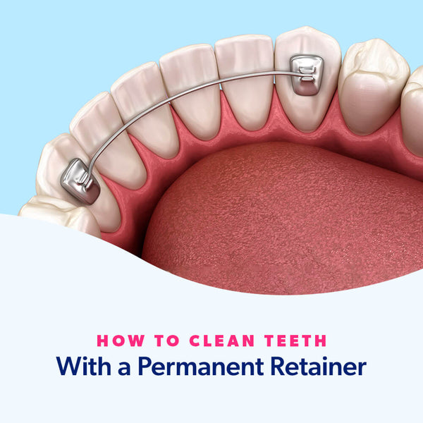 How to Clean Teeth With a Permanent Retainer