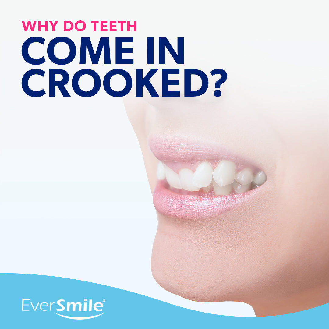 Why Do Teeth Come in Crooked?