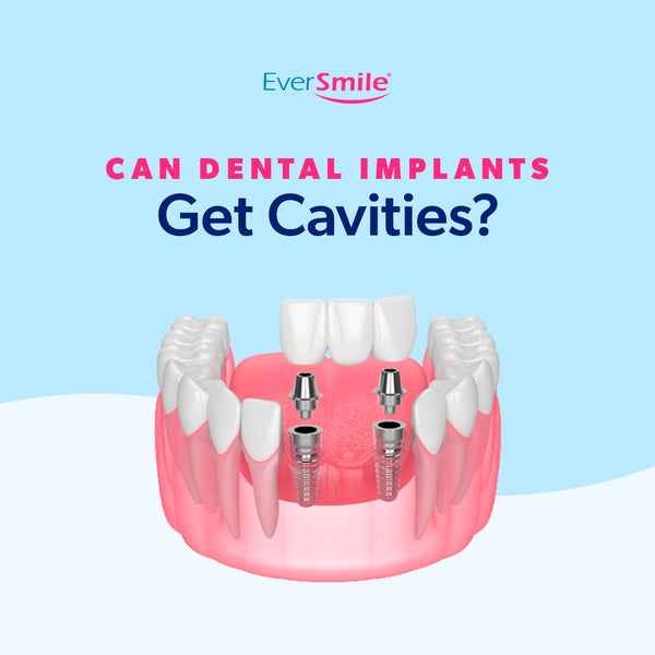 Can Dental Implants Get Cavities?
